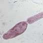 Cercaria