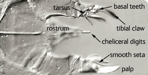 View of the underside of the gnathosoma, comprising the structures involved in feeding