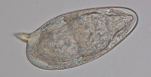 Schistosoma mansoni egg