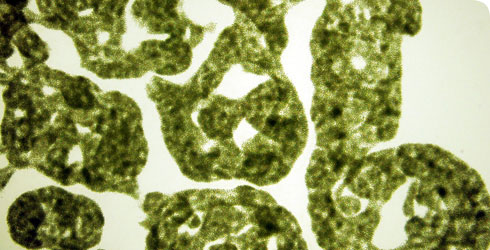 Microcystis aeruginosa