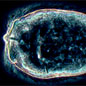 The miracidium stage of Schistosoma mansoni.
