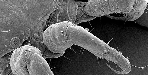 Pediculus humanus